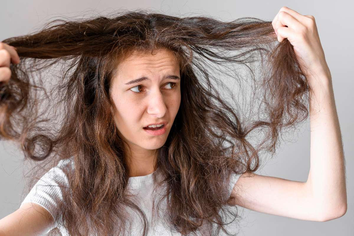 A young girl stressed for thinning of her hair.