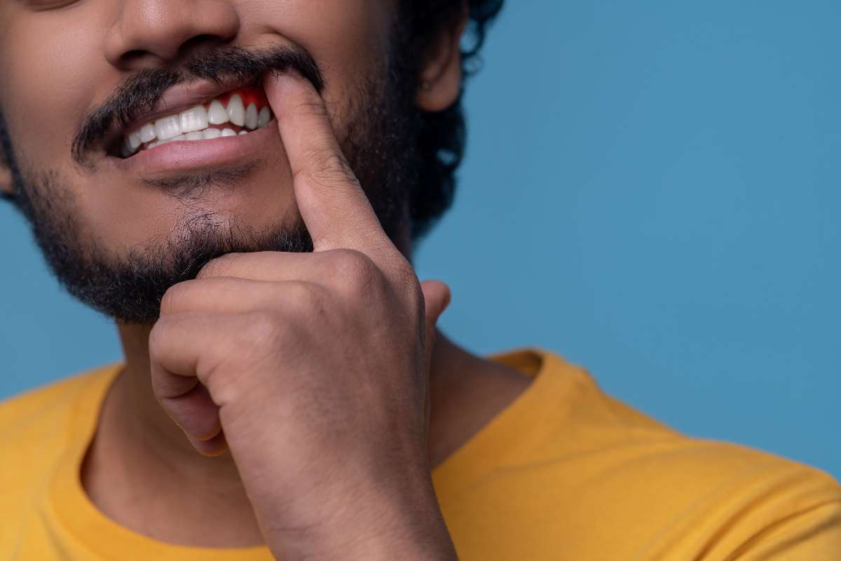 A man pointing to its red diseased gums, one of the major causes of Toothache 